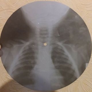Grateful Dead - Rain And Snow - Ussr Georgian X - Ray Roentgen Bones Skull Record