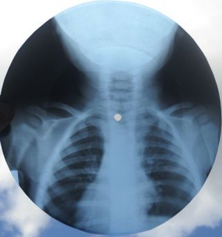 GRATEFUL DEAD - RAIN AND SNOW - USSR GEORGIAN X - RAY ROENTGEN BONES SKULL RECORD 2
