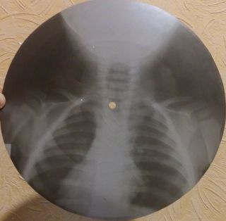 GRATEFUL DEAD - RAIN AND SNOW - USSR GEORGIAN X - RAY ROENTGEN BONES SKULL RECORD 3