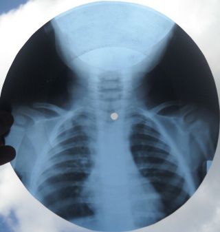 GRATEFUL DEAD - RAIN AND SNOW - USSR GEORGIAN X - RAY ROENTGEN BONES SKULL RECORD 4