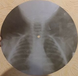 GRATEFUL DEAD - RAIN AND SNOW - USSR GEORGIAN X - RAY ROENTGEN BONES SKULL RECORD 5