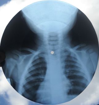 GRATEFUL DEAD - RAIN AND SNOW - USSR GEORGIAN X - RAY ROENTGEN BONES SKULL RECORD 6