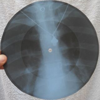 QUEEN - SON AND DAUGHTER - USSR GEORGIAN X - RAY ROENTGEN RIBS BONES RECORD 5