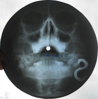 Yardbirds - For Your Love - Ussr Georgian X - Ray Roentgen Skull Bones Record