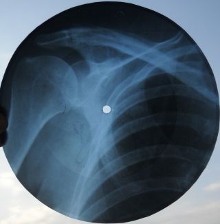 Jerry Lee Lewis - Wild One - Unique Ussr Georgian X - Ray Roentgen Bones Record