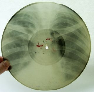 X - Ray 78rpm Dolskis Two Songs Ussr Bones Schoolgirl Ribs Roentgen With Date 1955