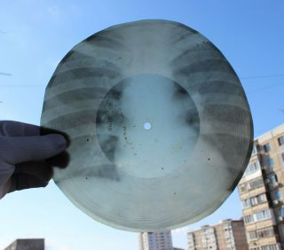 Rare Ussr X - Ray 78rpm Audio Roentgen 1950s Record Bones Leschenko Studentochka