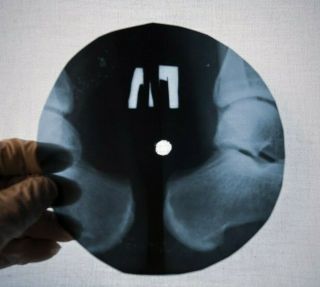 Elvis Presley Hound Dog X Ray Ussr Vinyl Record Music On Bones Roentgen