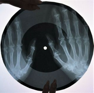 Simon and Garfunkel - Homeward Bound X - RAY USSR ROENTGEN Bones Records 2