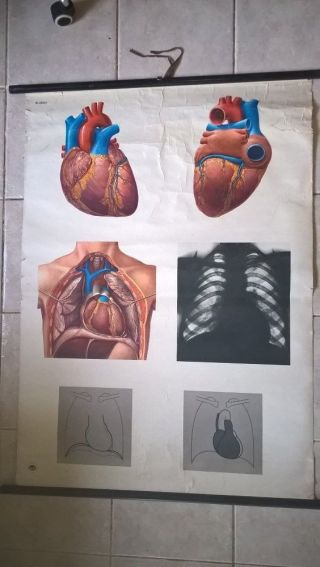 Vintage Medical Pull Down School Chart Of Heart