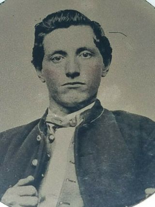 Rare 1860s Circular Tintype Of Civil War Soldier