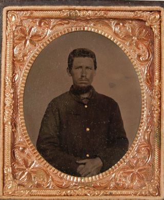 1860s Sixth Plate Civil War Tintype Photo Of Union Army Soldier In Hard Case