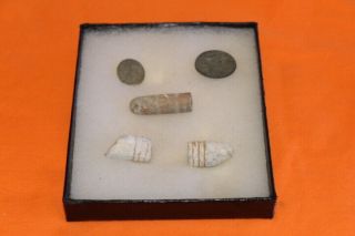 1273 - Dug Civil War Buttons And Bullets In A Case