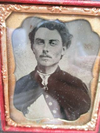 Civil War Union Soldier Tintype - Id ' d Pat Dixon 2