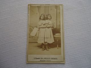 Antique Cdv Photograph - Millie Crissie - African American Conjoined Twins