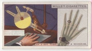 Early Radiology Crookes X - Ray Tube Sciagram 90,  Y/o Ad Trade Card