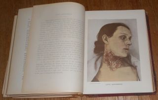 1903 Antique Medical Book Photographic Atlas Of The Diseases Of The Skin