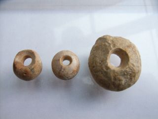 3 Ancient Neolithic Petrified Sea Urchin Beads,  Stone Age,  Rare Top