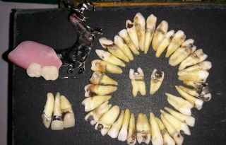 Vintage 37 Real Human Teeth Study Horror Dental Student Oddities Gold Fillings