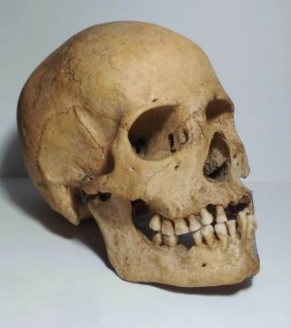 1:1 Vintage Medical Anatomy Human Skull Model Training Doctor Bone