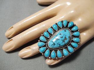 Colossal Important Vintage Navajo Turquoise Sterling Silver Tonya Ring