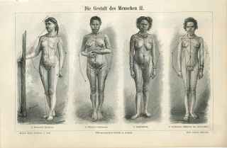 1894 Nude Women Body Shape German Native Australian Arab Indian Engraving Print