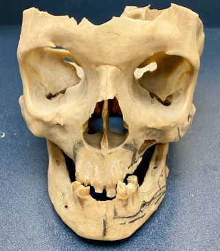 Real Human Skull,  Articulated Medical /dental Model Male