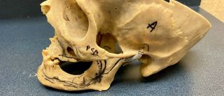 Real Human Skull,  Articulated Medical /Dental Model Male 2