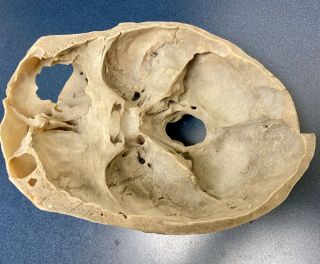Real Human Skull,  Articulated Medical /Dental Model Male 3