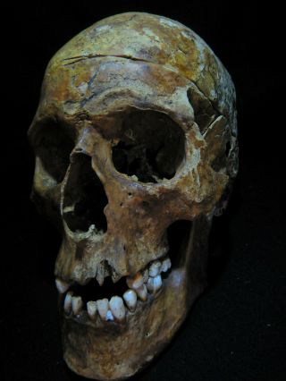 Human Skull 1:1 Scale As Seen On Netflix.