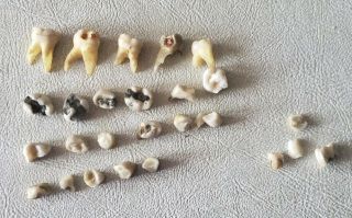 23 Real Human Teeth Roots Adult & Baby Fillings For Research Study Dental School