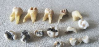 23 Real Human Teeth Roots Adult & Baby Fillings For Research Study Dental School 2