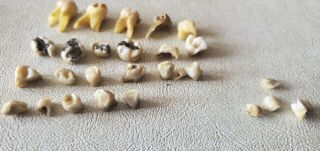 23 Real Human Teeth Roots Adult & Baby Fillings For Research Study Dental School 3