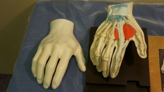 1967 Human Hand Anatomical Display Model Merck Sharp & Dohme Indocin Complete