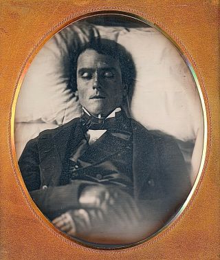 Breathtaking Post Mortem Handsome Young Man In Bed 1/6 Plate Daguerreotype E353