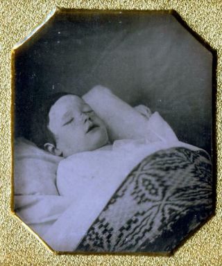 Post Mortem Of Identified Young Boy - Sharp Daguerreotype,  C.  1850