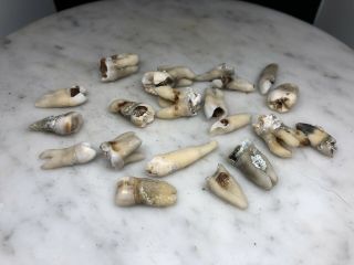 HUMAN TEETH FOR SCHOOL RESEARCH SET OF 20 REAL Antique Dentist Horror Prop 2