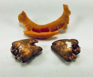 Real Human Teeth - Adult - Gold Copper Metal - Research Study Dental School