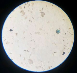 Fine Antique Microscope Slide Diatoms From " California Guano No.  3 "