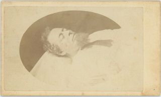 Post Mortem Man With Beard In Bed Buffalo,  York Cdv Carte De Visite V438