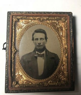 1/9th Plate Ambrotype Of A Handsome Man.  Ornate Mat And Preserver.  Half Case.