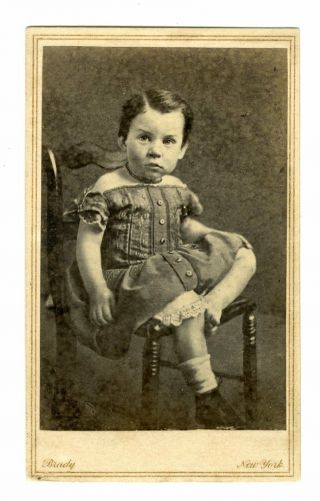 Brady Cdv Of Child With One Shoe On And One Shoe Off