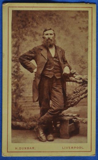 Cdv Photo Man Thick Beard By Dunbar Liverpool England Uk 1860s