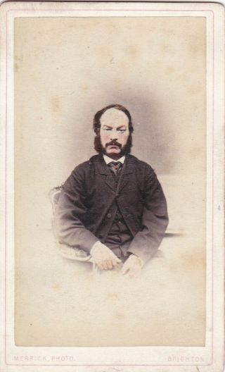 Antique Cdv Photo - Hand Coloured Portrait Of Bearded Man.  Brighton Studio